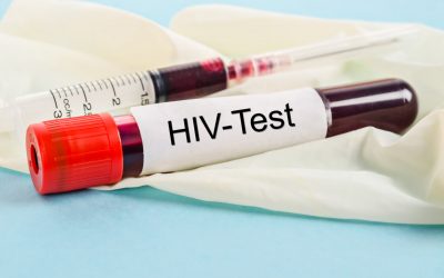 HIV RNA Test