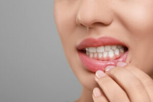 how contagious gingivitis maintain good oral hygiene